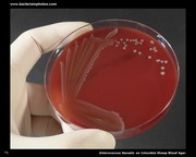 Enterococcus on sheep blood agar plate